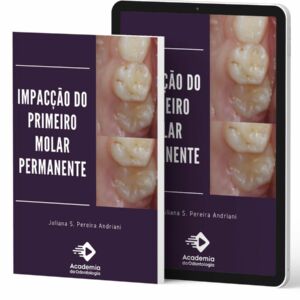 impacção