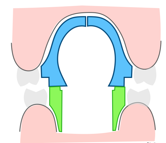 Capa Curso Pistas Planas Indiretas