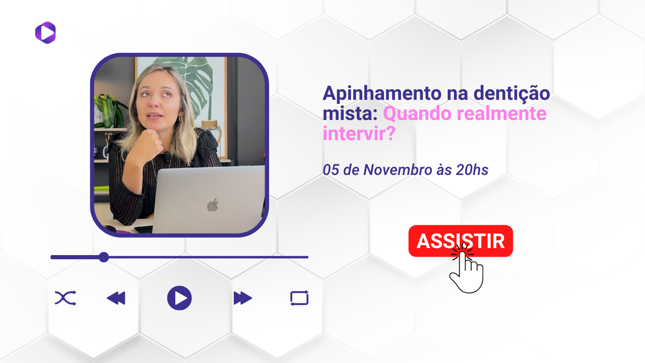 Apinhamento na dentição mista: Quando realmente intervir?