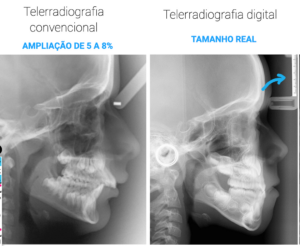 ampliação radiográfica. cefalometria