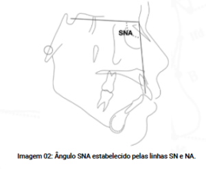 SNA- cefalometria